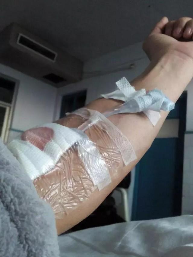 ​食道癌晚期抗癌成功人士（一位食道癌患者的生存日记） 第4张